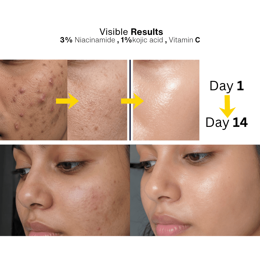 Luwia Prime Visible Results